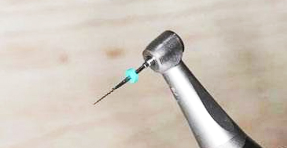 精細切割，極大程度保留牙神經(jīng)，根管治療成功率極高