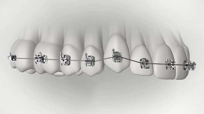 承德市哪家口腔醫(yī)院口腔正畸做得好？惟德口腔醫(yī)院來告訴您