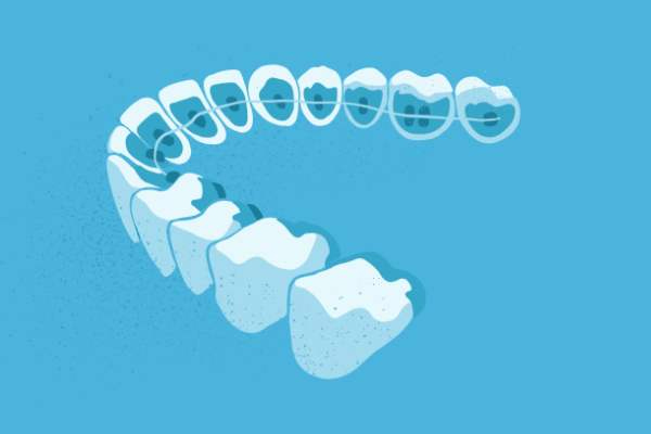 惟德口腔醫(yī)院口腔正畸好不好？