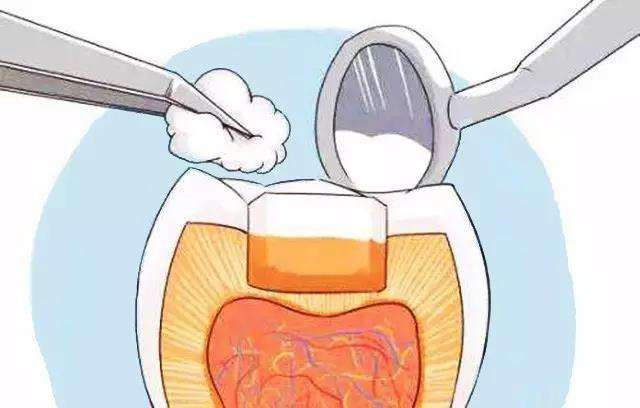 惟德口腔淺析在承德孩子牙齒蛀牙補(bǔ)牙需要多少錢(qián)